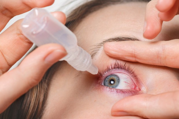Kesalahan Menggunakan Lensa Kontak Berbahaya Bagi Mata